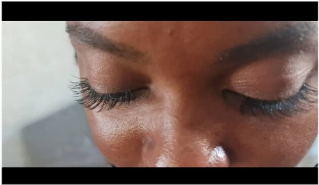 Cat Eye